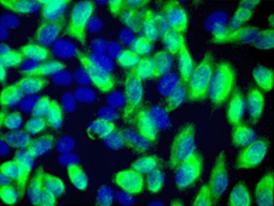 4c5 anti ddk monoclonal antibody feature image