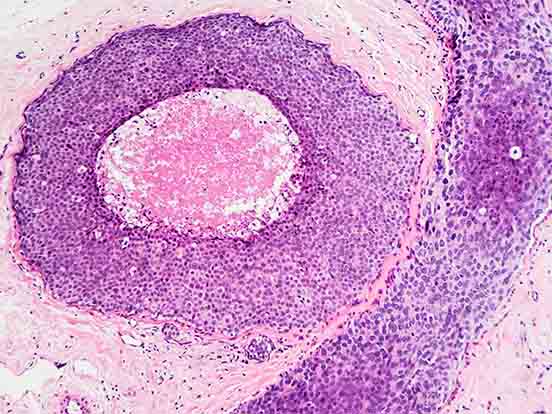 Cancerseq featured image