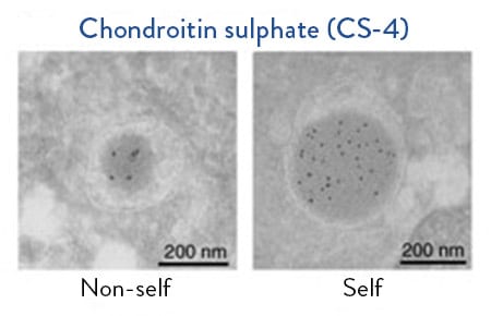 Chondroitin sulphate