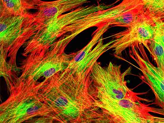 Bioporter featured image