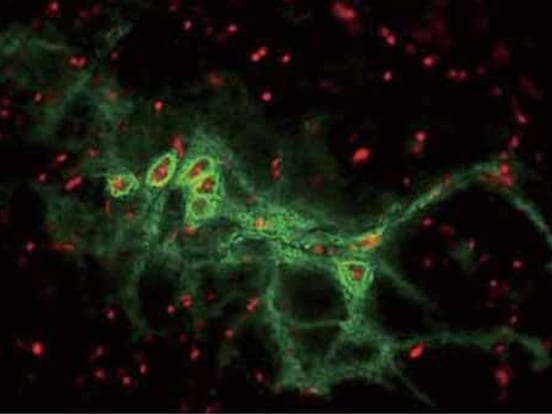 Chondroitinase-ABC Chondroitin Sulfate Proteoglycans (CSPGs) are involved in the inhibition of axon regeneration after various forms of damage to the Central Nervous System, including stroke and spinal cord injury. The enzyme Chondroitinase ABC (purified from Proteus vulgaris) degrades these CSPGs, and has been shown to promote functional recovery and neural regeneration in addition to its role as a tool in glycoanalysis.