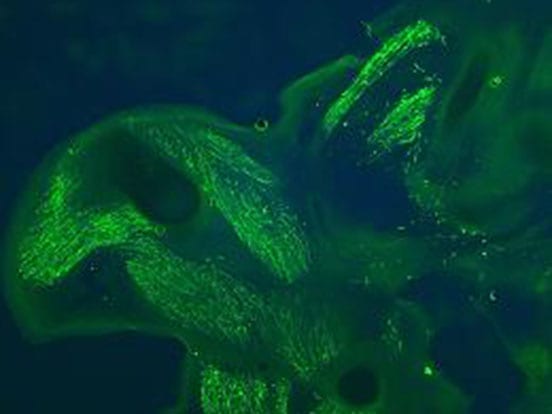 gfp_polyclonal_antibody_feature