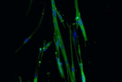 Well1_0.4_MyHC_2-400x269