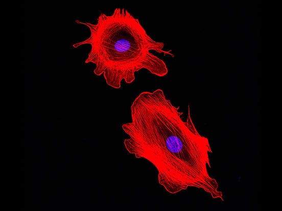 Confocal,Microscopy,Imaging,Of,Two,Cancer,Cells.,Cytoskeletal,Protein,Actin