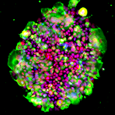 Fig. Staining images of ACE2-expressing iPS cells grown in StemFit® medium with iMatrix-511 as ECM after cryopreservation in STEM CELLBANKER® infected with SARS-CoV-2 virus. Green: SARS-CoV-2 N protein, Red: OCT3/4, Blue: DAPI. Image courtesy of Kazuo Takayama (CiRA, Kyoto University, Japan)