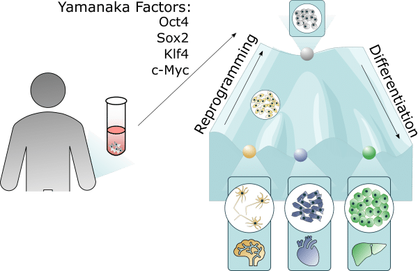 iPSC cell therapy
