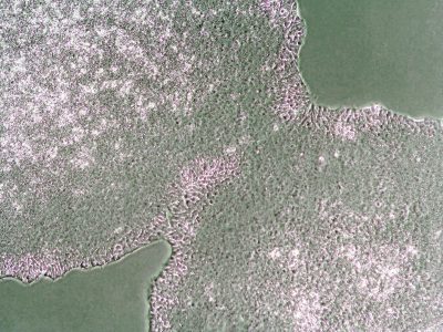 iPSC colonies iPSC colonies