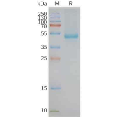 FLP100048-SLC7A11-Fig.2-SDS-PAGE-1-400x400