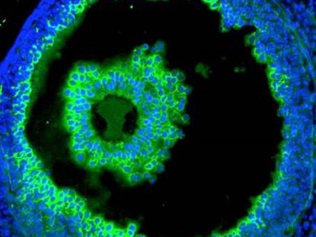 HA-staining