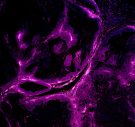 PECAM1 red DAPI blue in MM511(R toU) PDSX PECAM1 red DAPI blue in MM511(R toU) PDSX in MatriMix